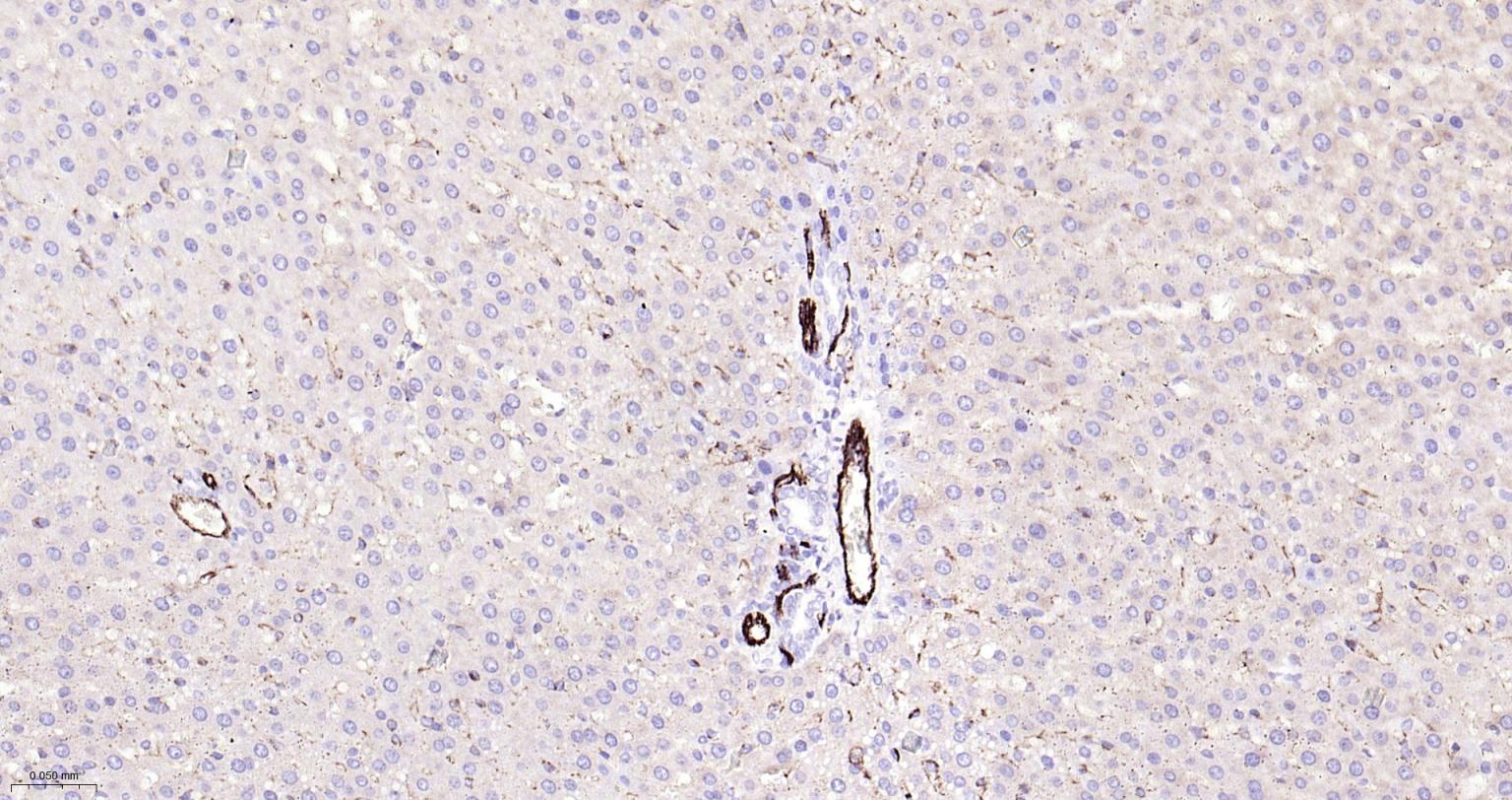血小板内皮细胞黏附分子-1抗体