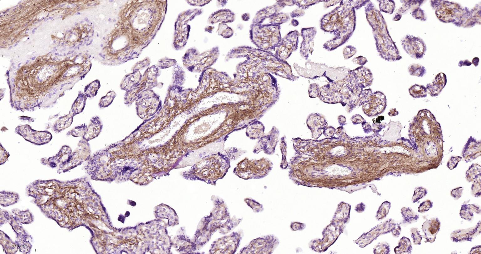 I型胶原蛋白/胶原蛋白1/1型胶原蛋白/I型胶原a1抗体
