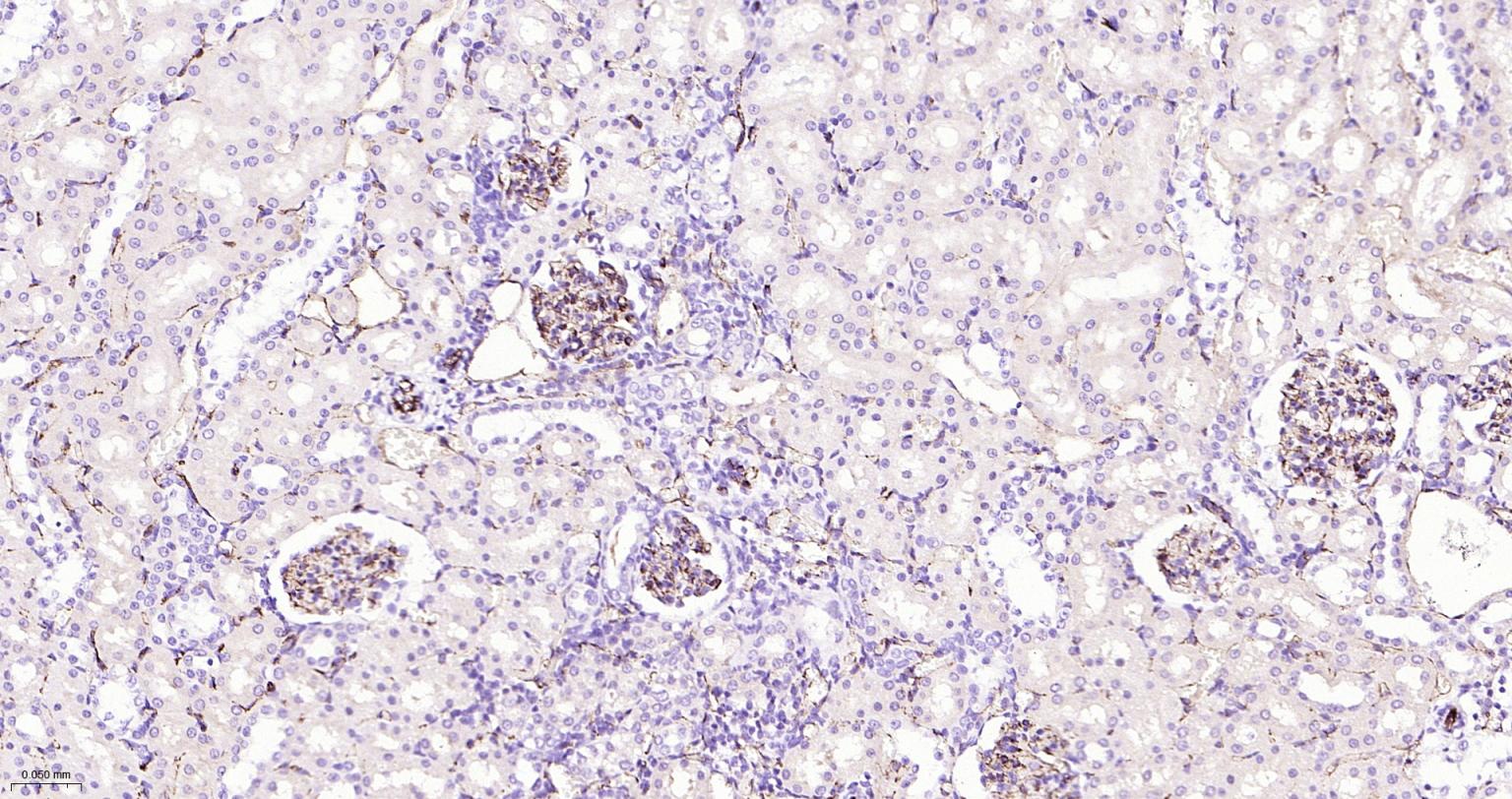 血小板内皮细胞黏附分子-1抗体