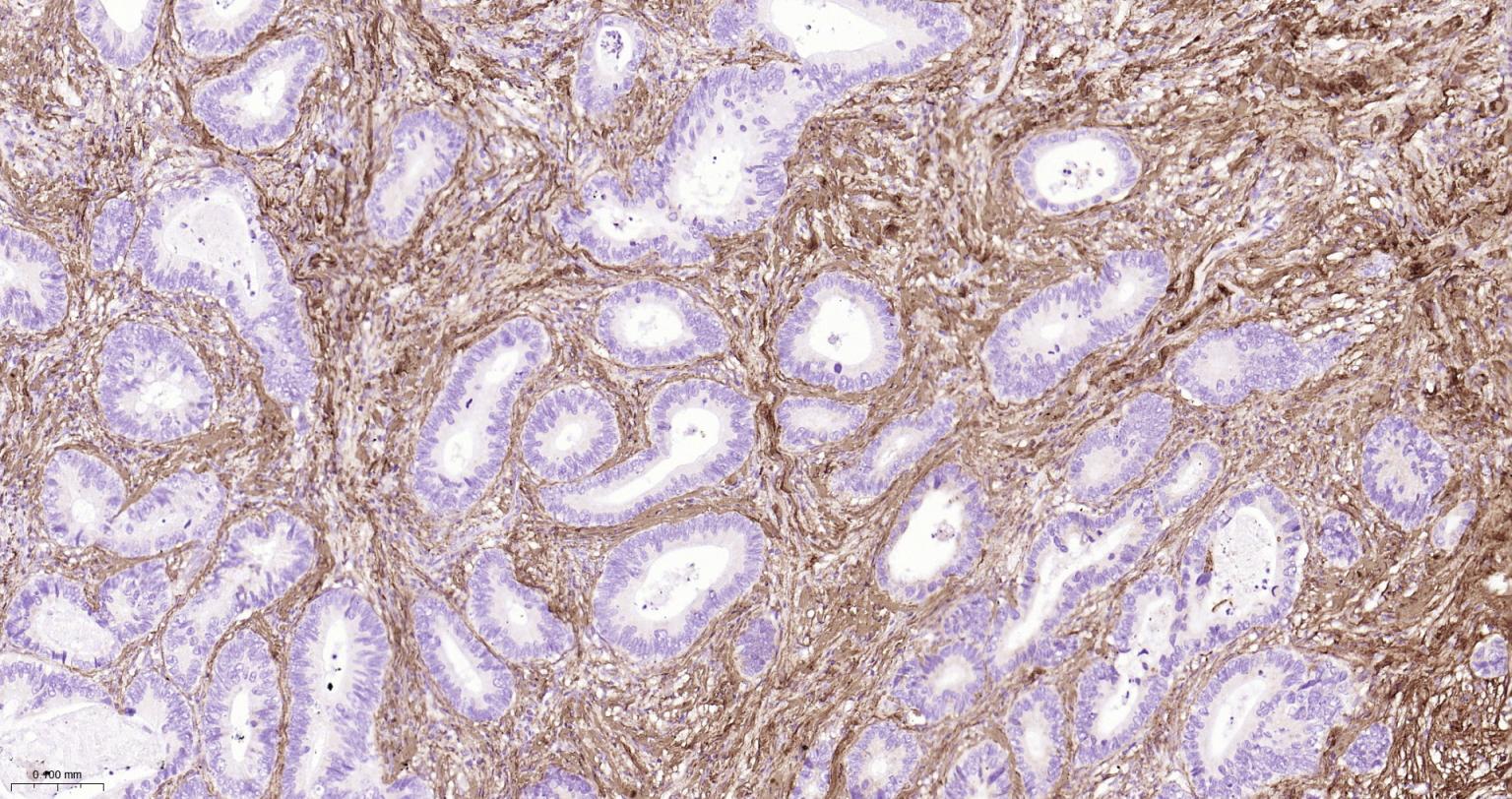 I型胶原蛋白/胶原蛋白1/1型胶原蛋白/I型胶原a1抗体