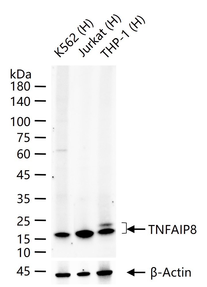 TNFAIP8 Recombinant Rabbit mAb (一抗) - WB | Bioss