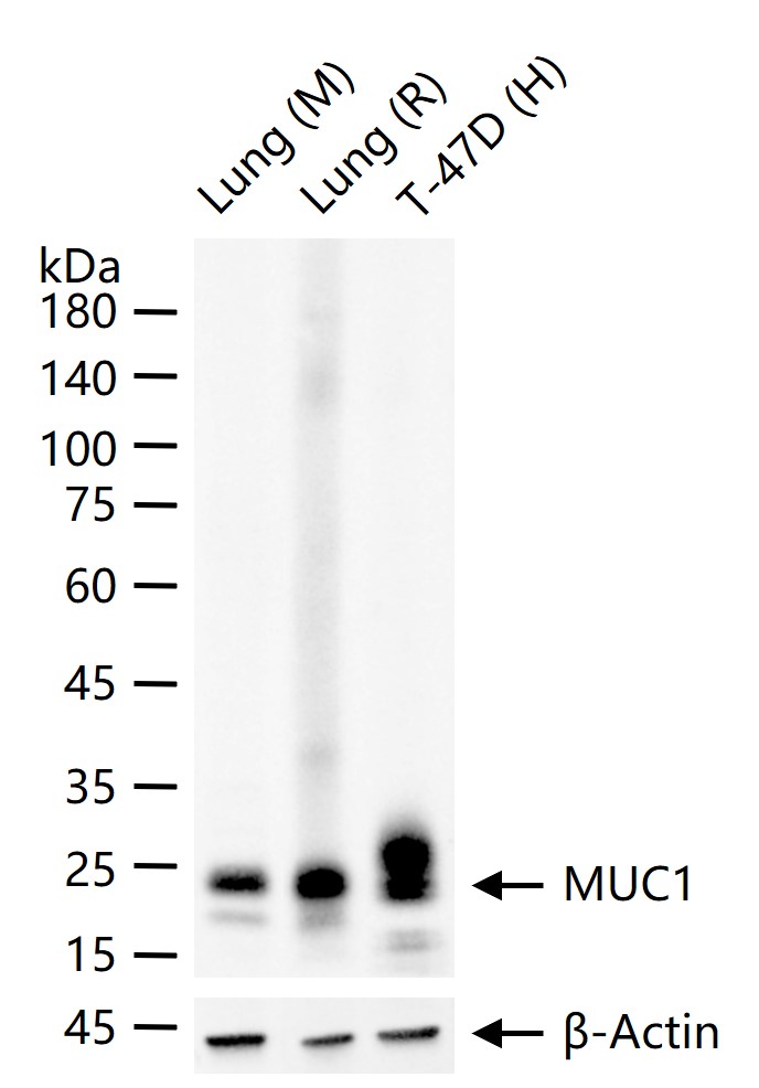 粘蛋白-1重组兔单抗