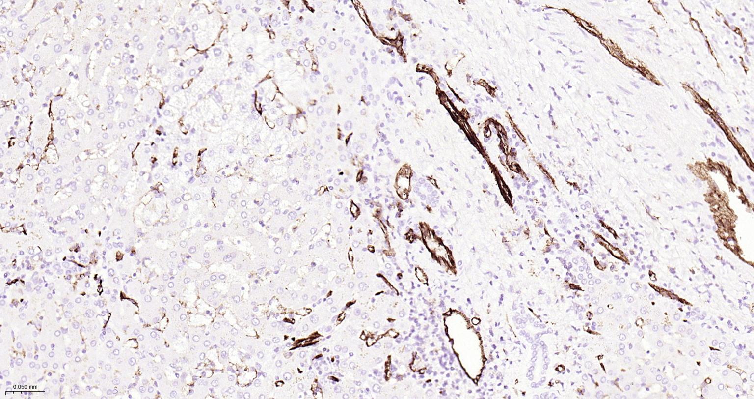 血小板内皮细胞黏附分子1单克隆抗体