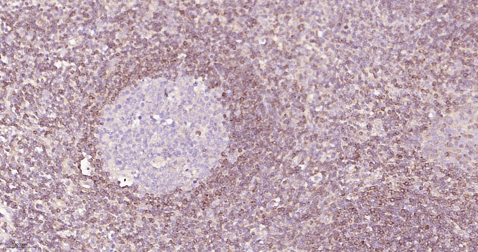 Bcl-2重组兔单抗