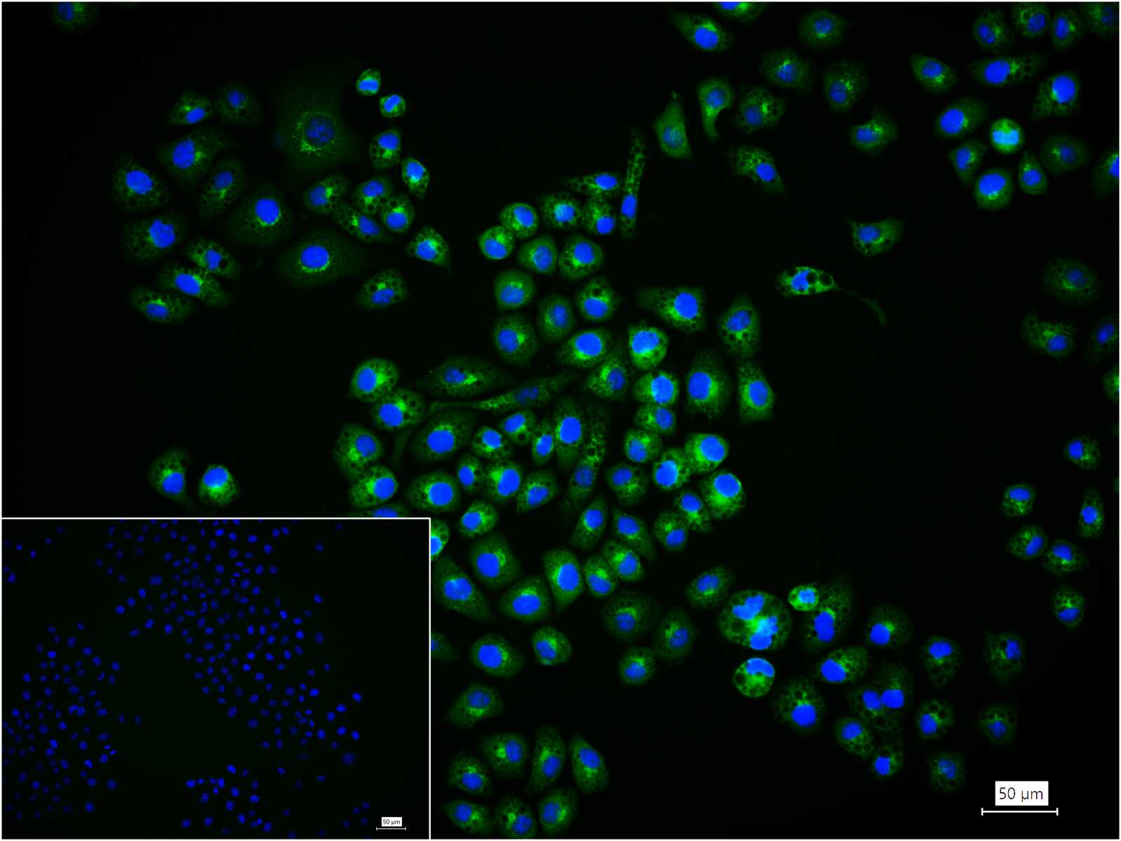 自噬微管相关蛋白轻链3重组兔单抗