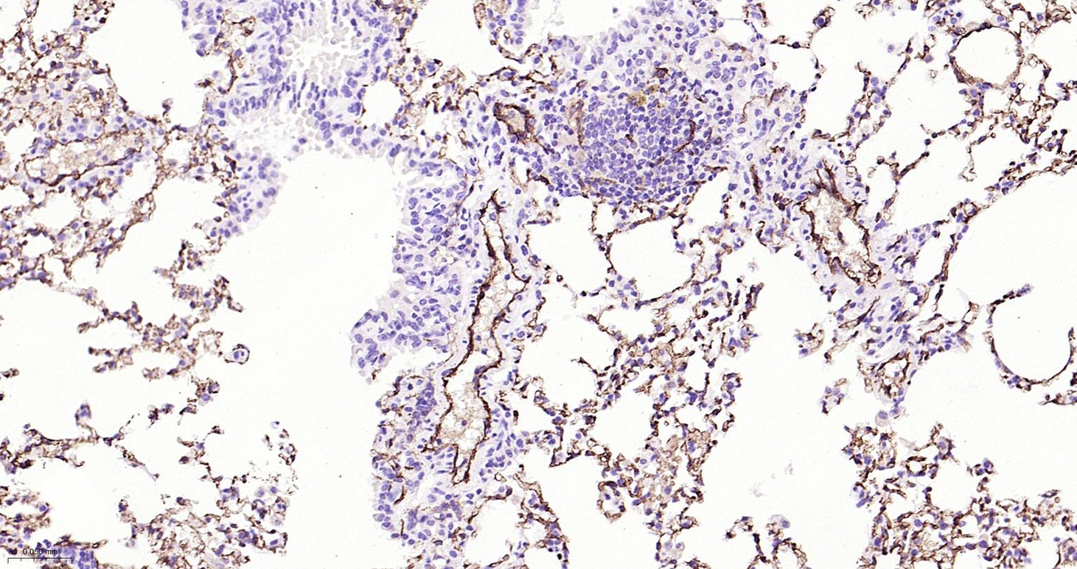 血小板内皮细胞黏附分子-1抗体