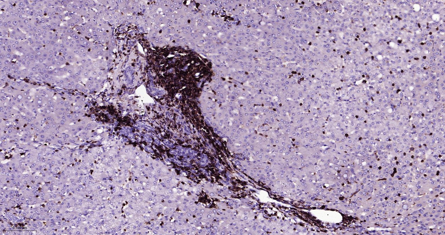 白细胞共同抗原CD45重组兔单抗