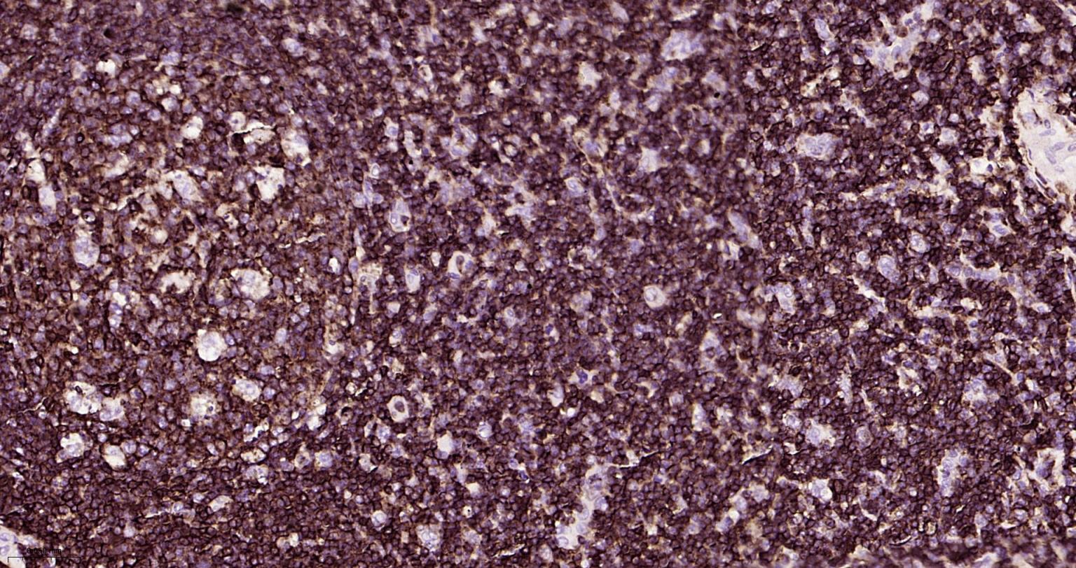 白细胞共同抗原CD45重组兔单抗