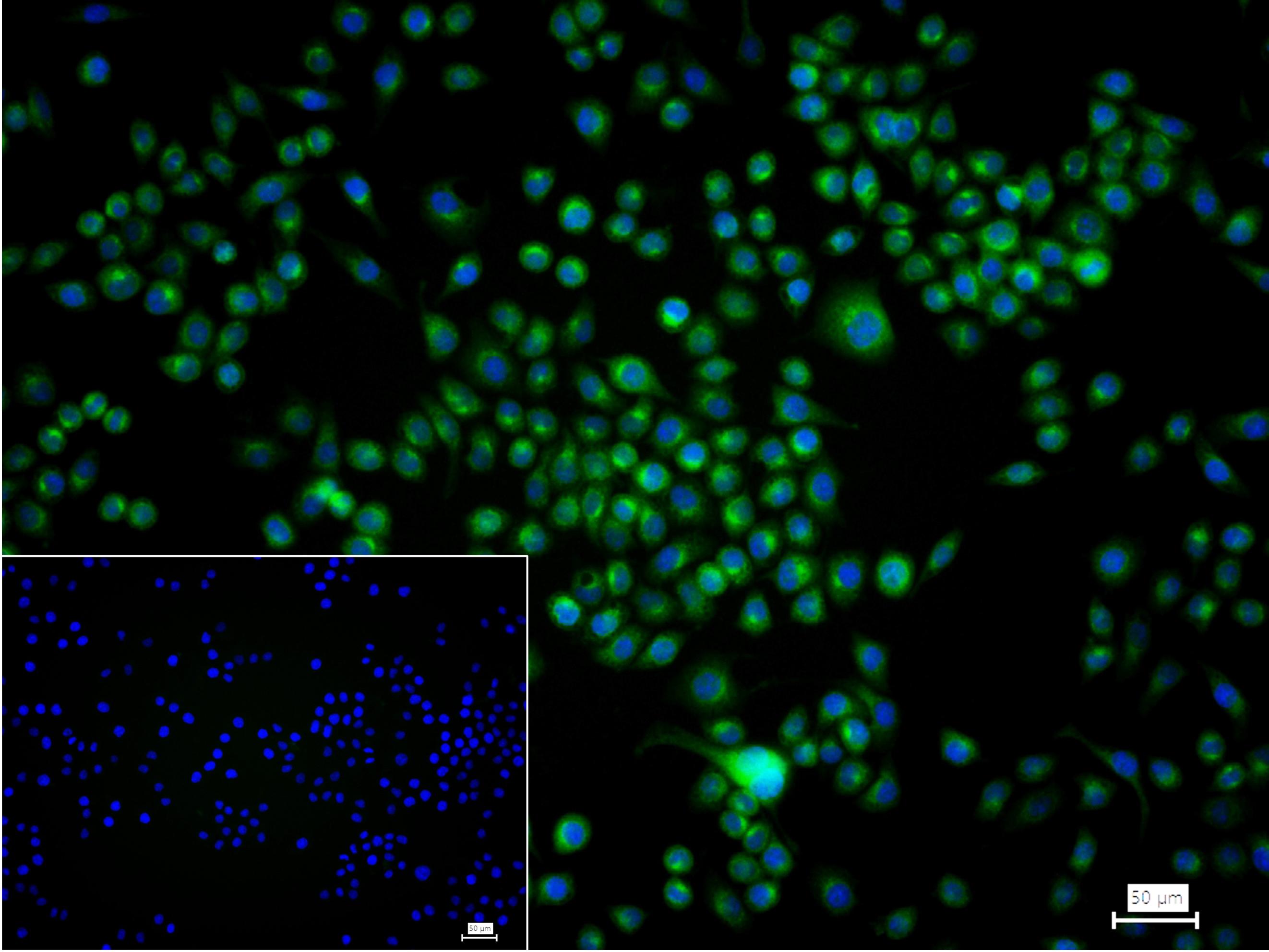 Bcl-2重组兔单抗