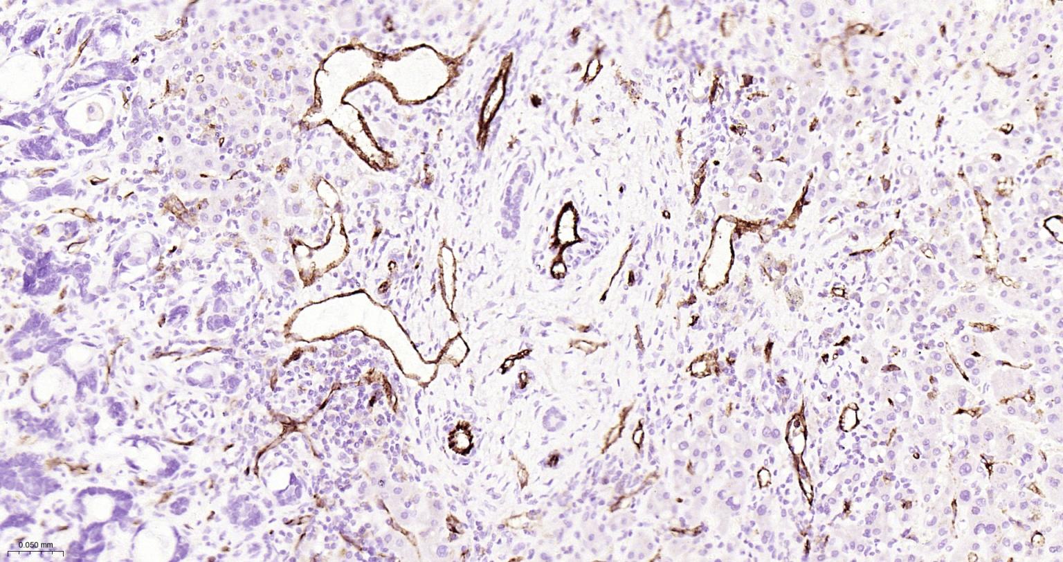 血小板内皮细胞黏附分子1单克隆抗体