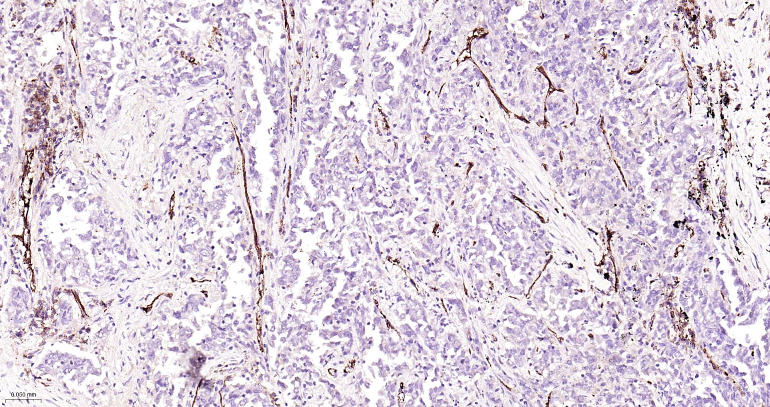 血小板内皮细胞黏附分子-1重组兔单抗