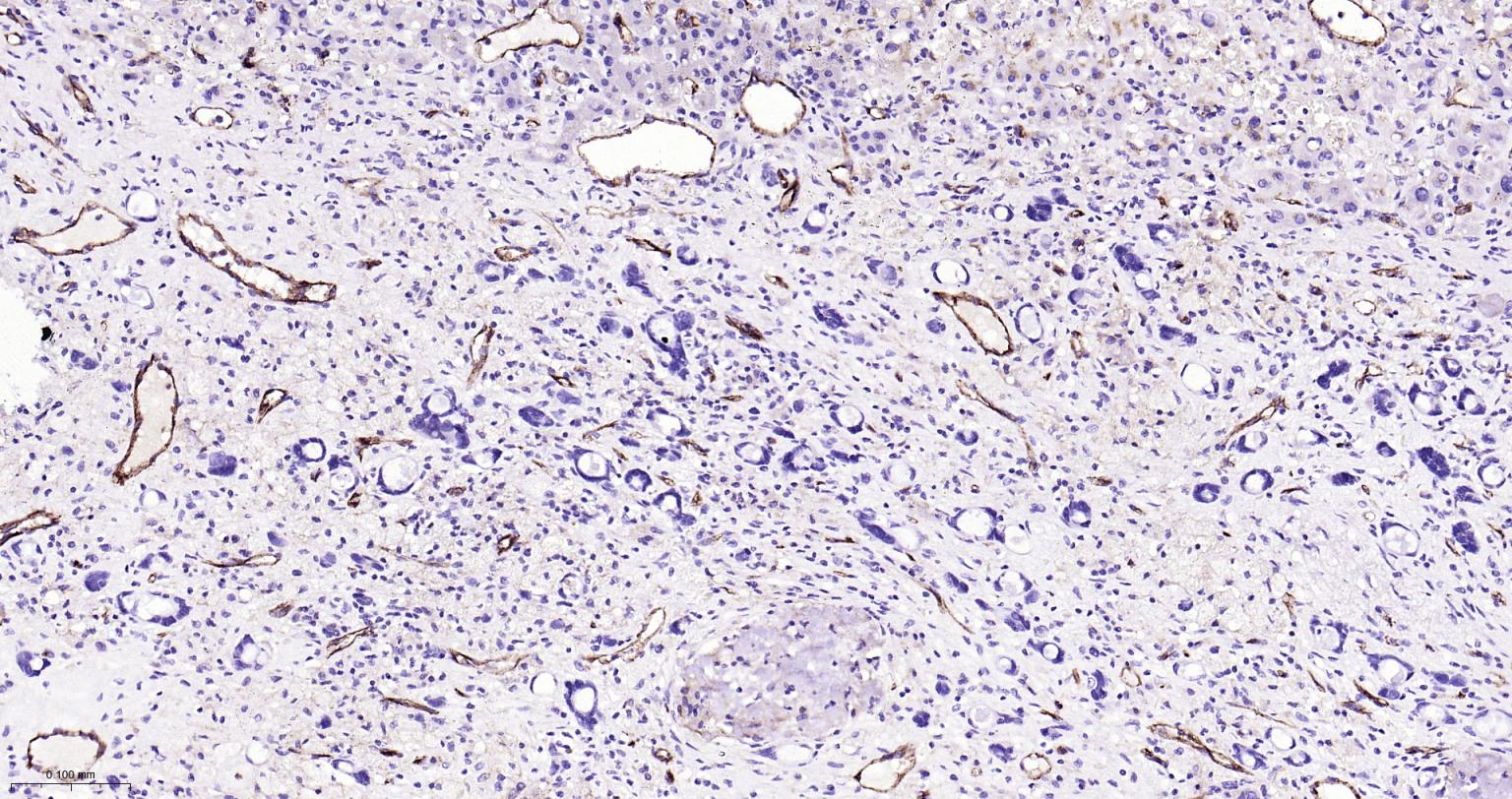 血小板内皮细胞黏附分子-1重组兔单抗