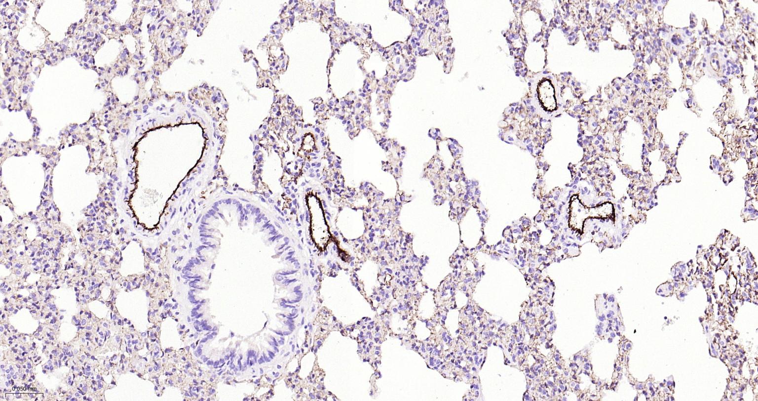 血小板内皮细胞黏附分子-1抗体
