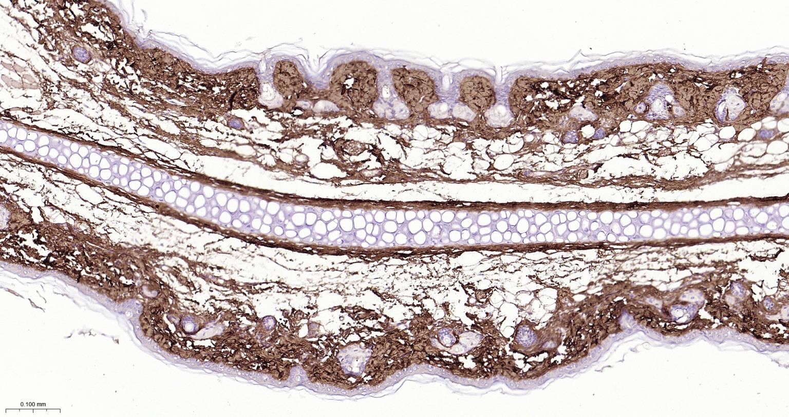 I型胶原蛋白/胶原蛋白1/1型胶原蛋白/I型胶原a1抗体