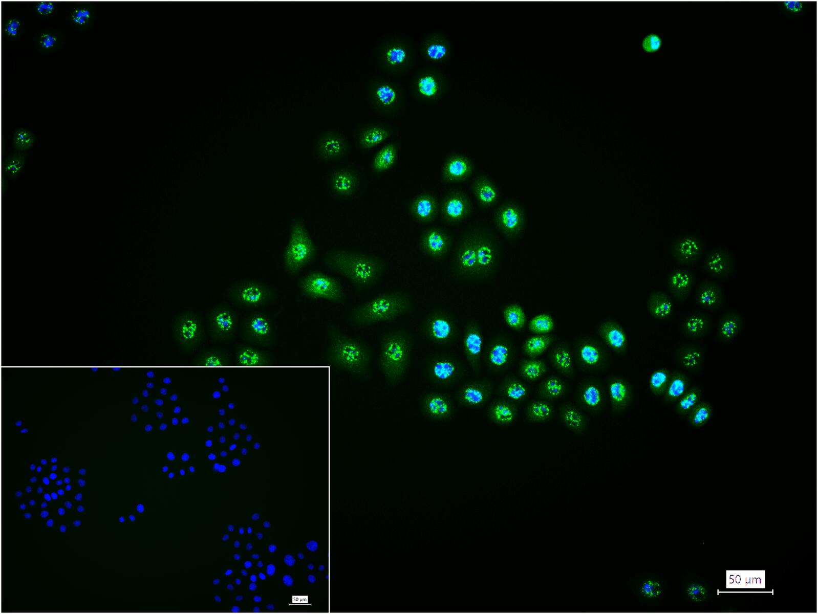 磷酸化氨基末端激酶1/2/3重组兔单抗