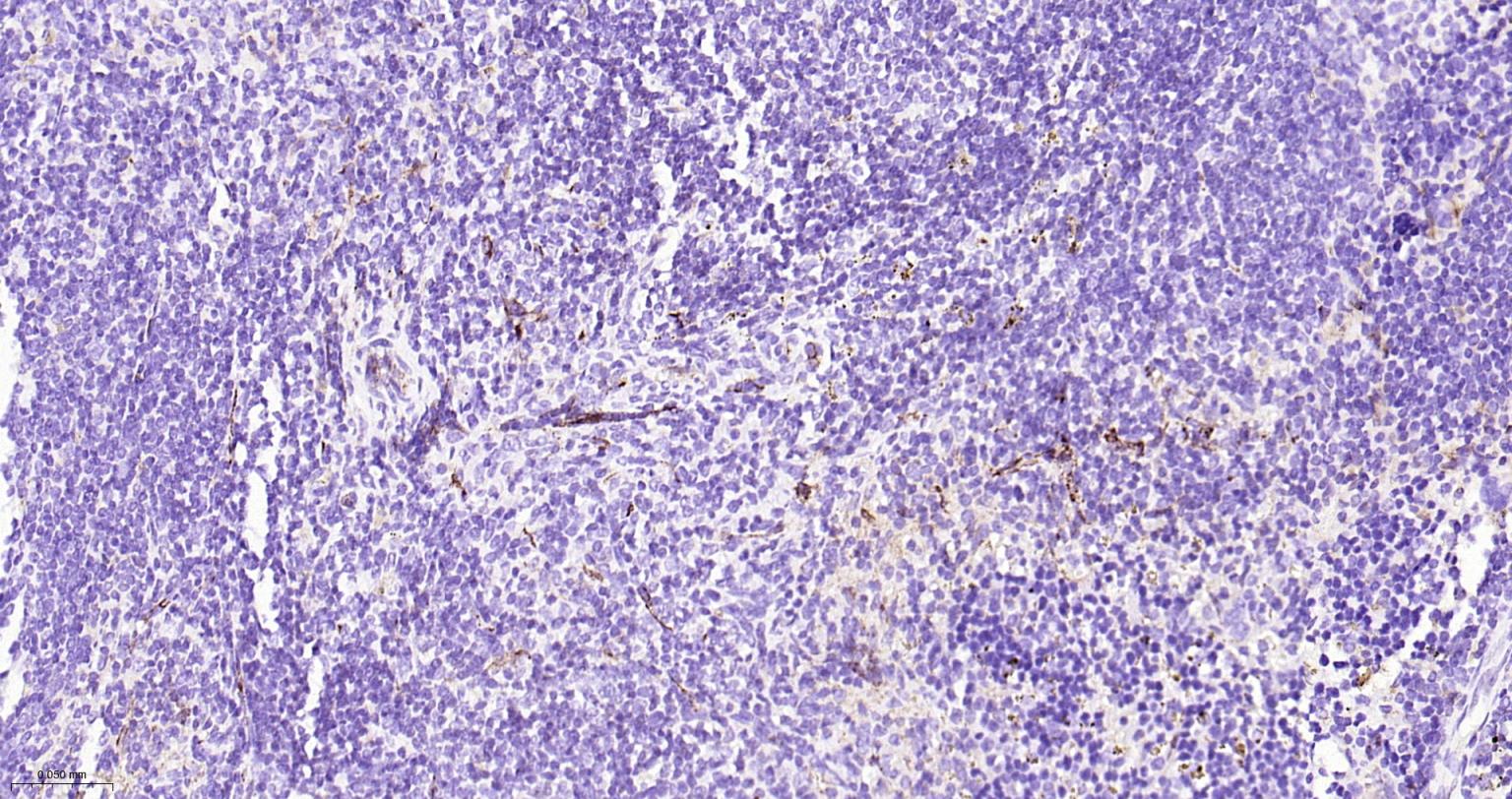 血小板内皮细胞黏附分子-1抗体
