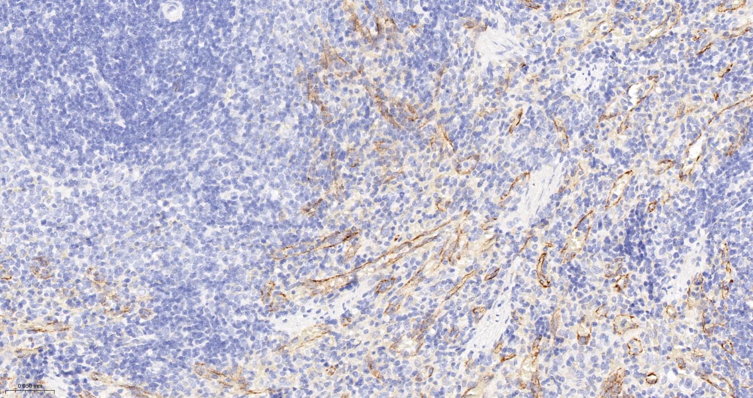 巨噬细胞甘露糖受体 (CD206)重组兔单抗-bsm-55604R