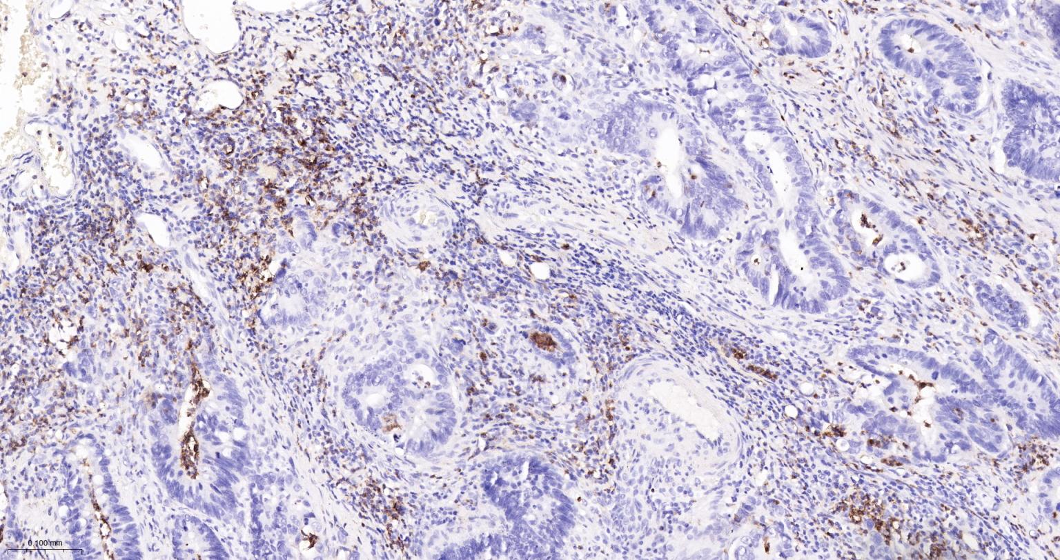 整合素αM单克隆抗体