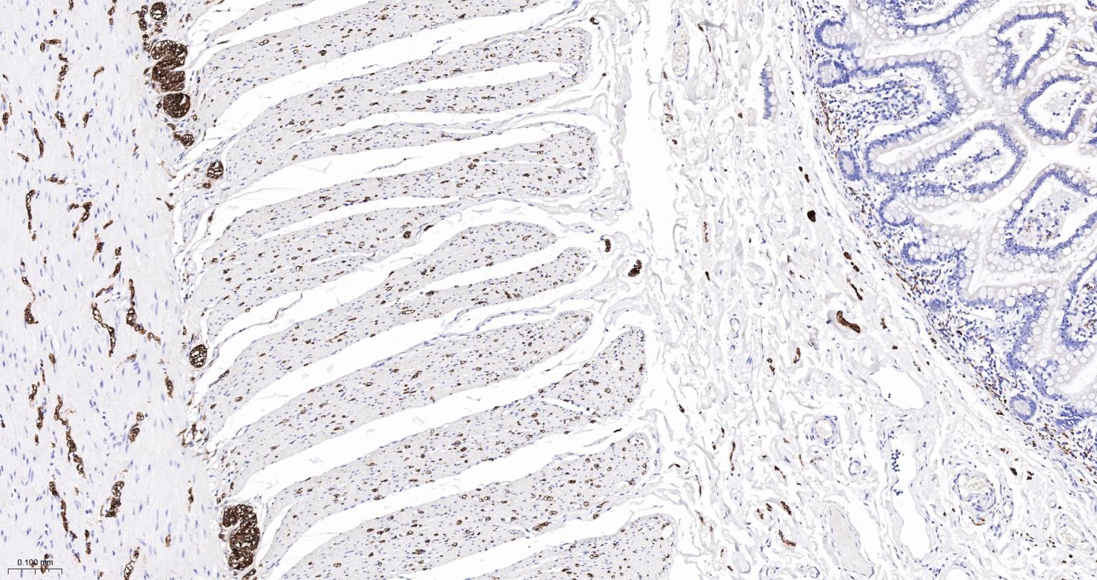 神经细胞胞浆蛋白9.5重组兔单抗