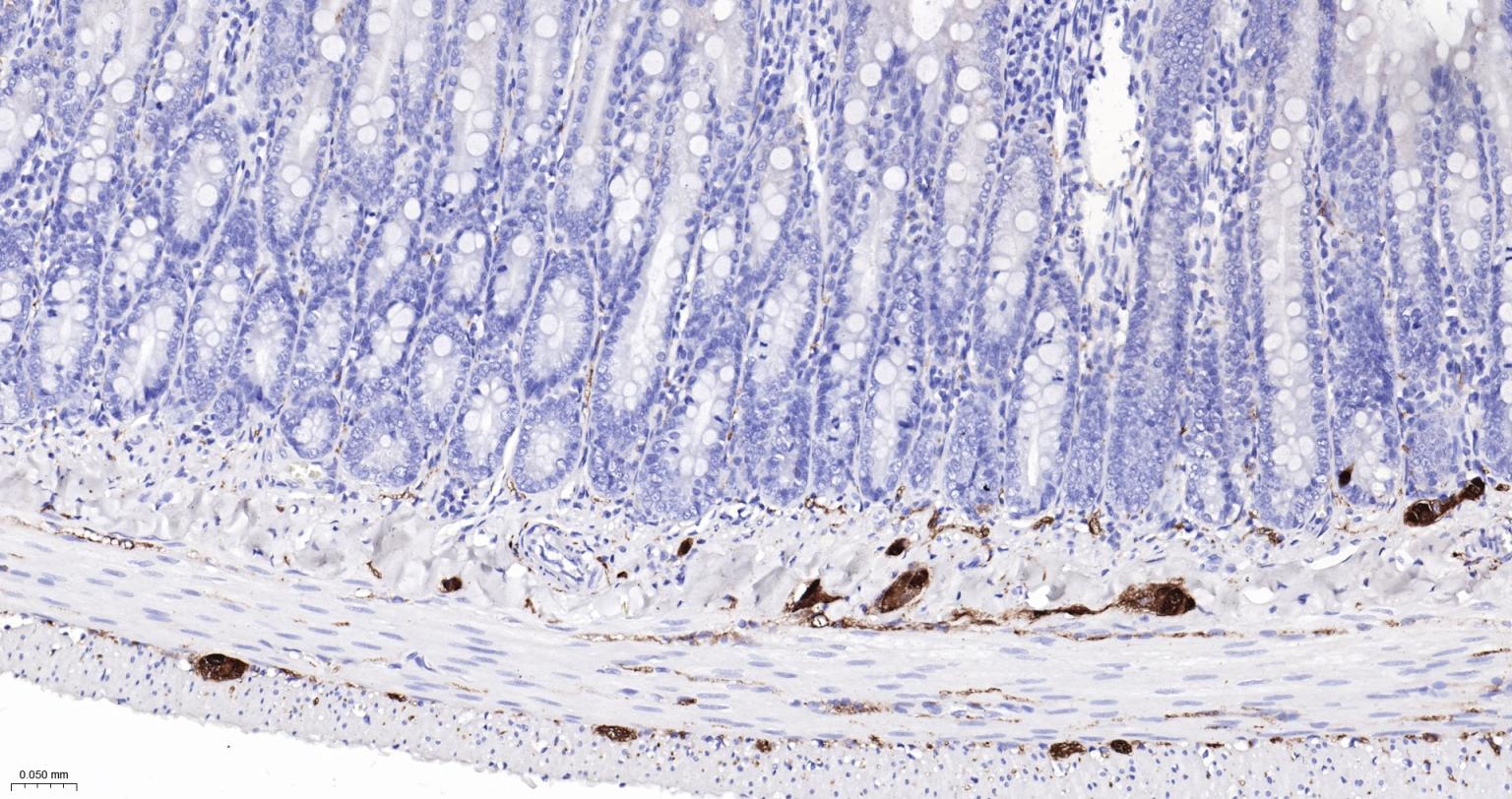 神经细胞胞浆蛋白9.5重组兔单抗