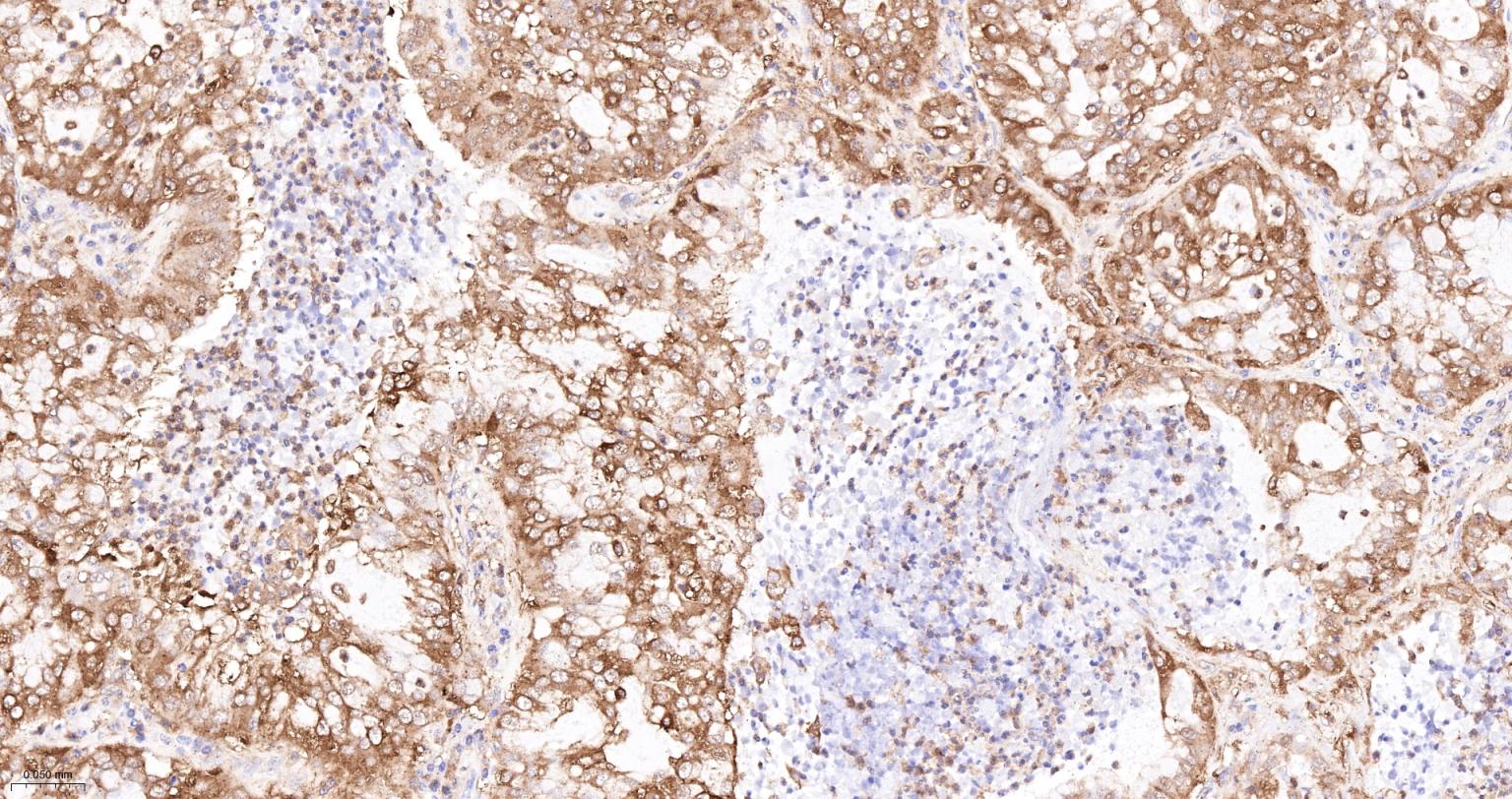 丙酮酸激酶M2重组兔单抗
