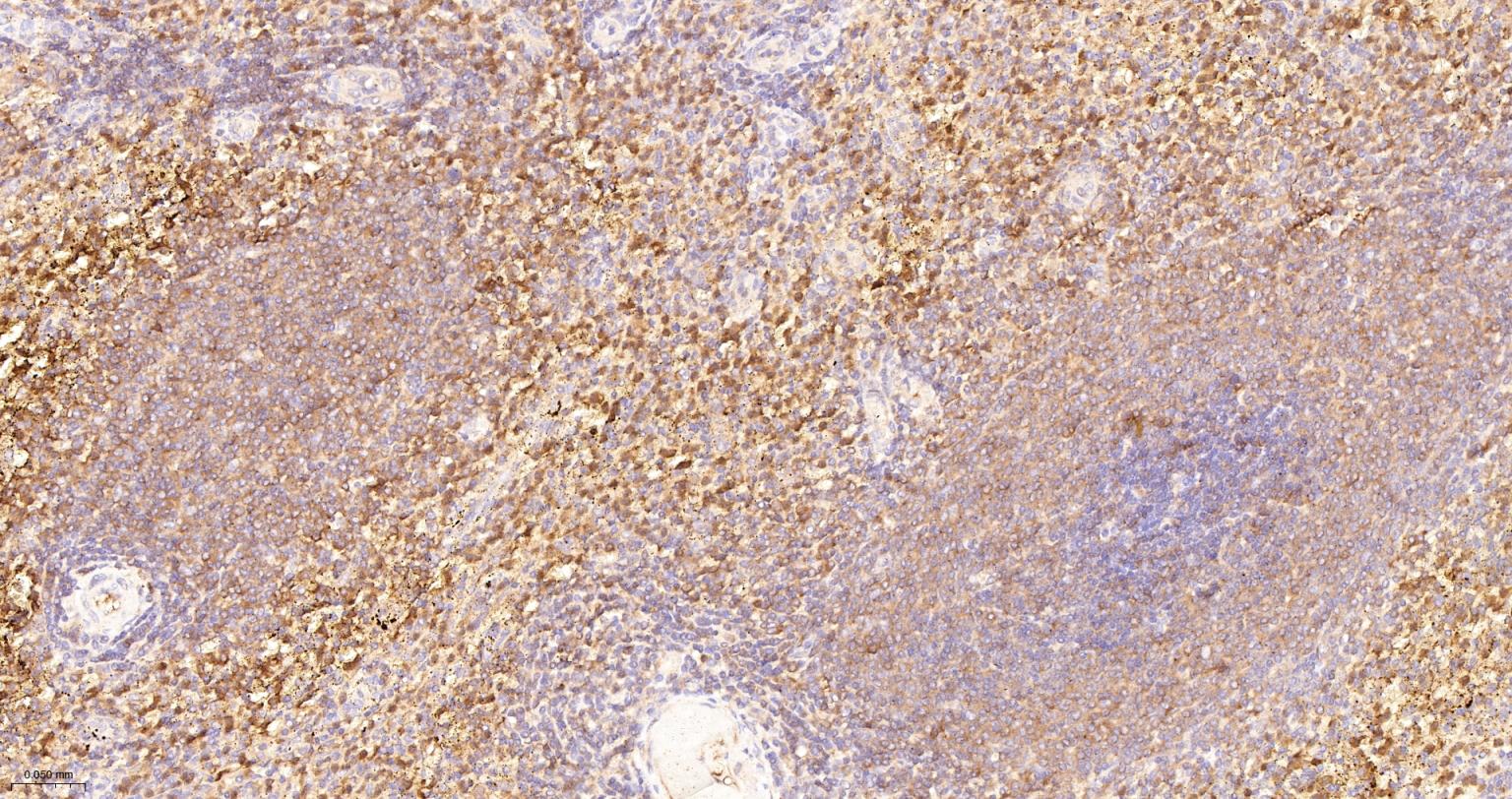 丙酮酸激酶M2重组兔单抗