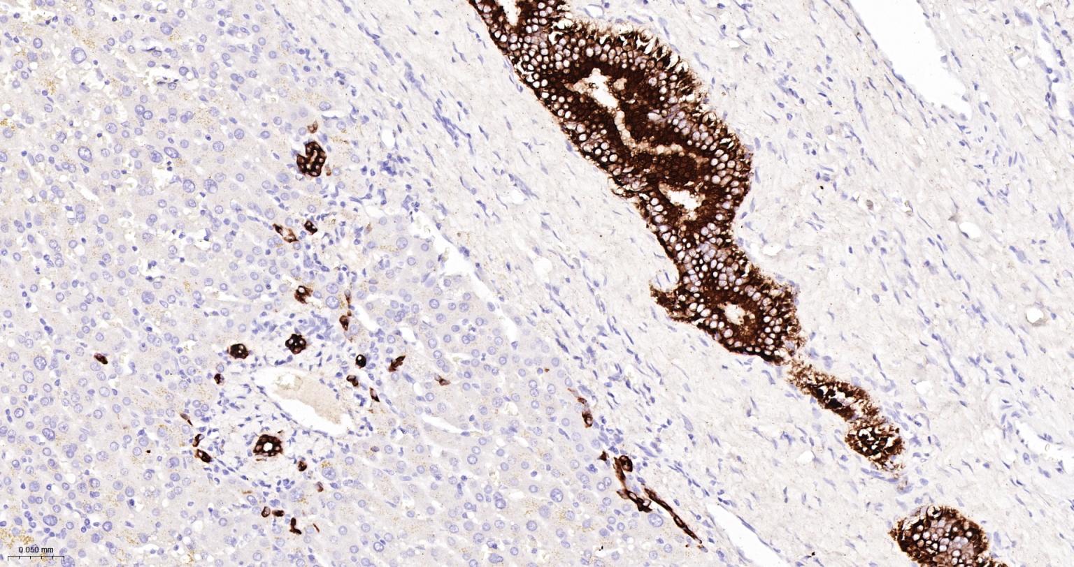 细胞角蛋白7重组兔单抗-bsm-60218R