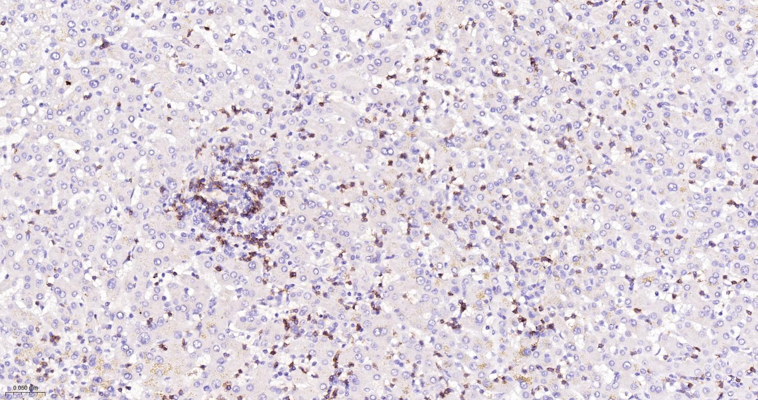 CD8A单克隆抗体-bsm-34251M