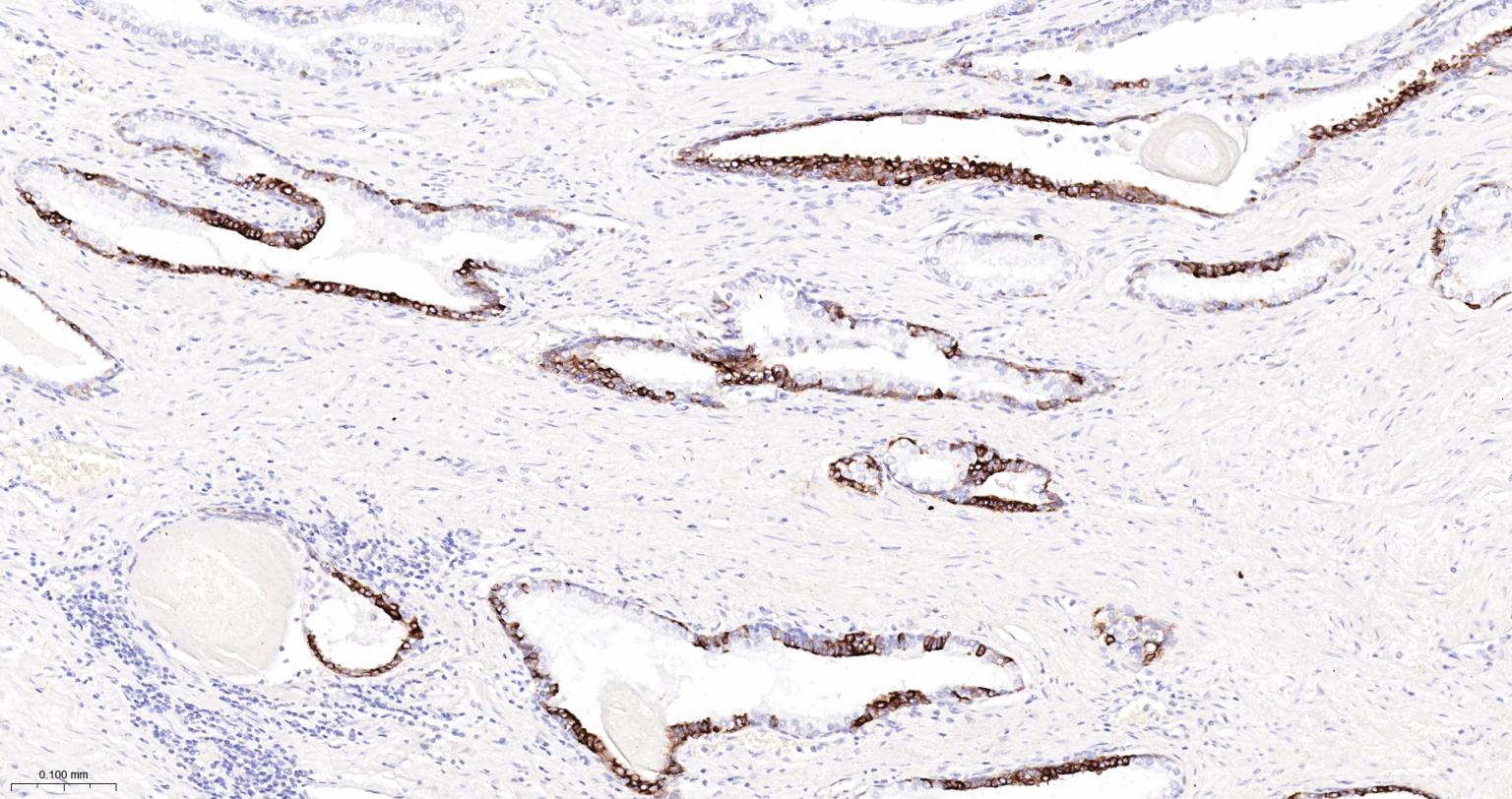 细胞角蛋白7重组兔单抗-bsm-60218R