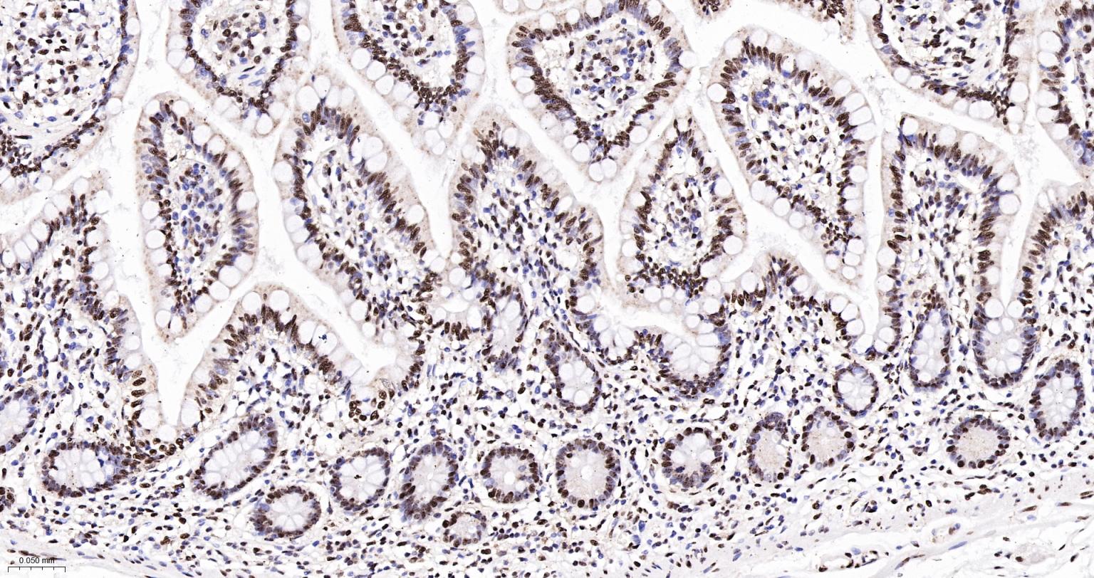 扑克蒙蛋白重组兔单抗