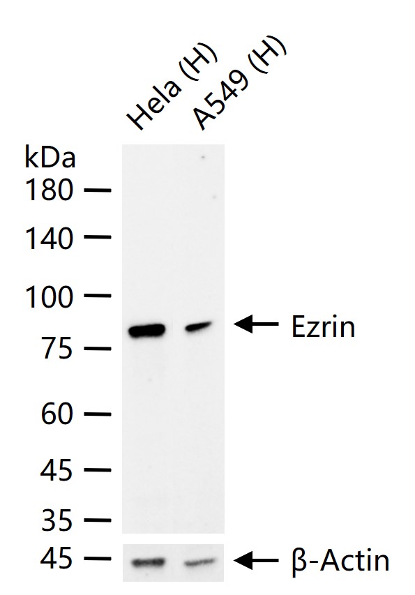 Ezrin Recombinant Rabbit mAb (一抗) - WB,IHC-P,IHC-F,IF | Bioss