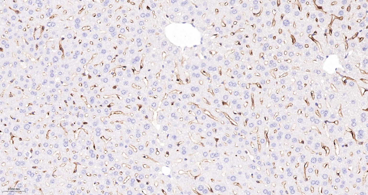 MRC1 | CD206 Recombinant Rabbit mAb (一抗) - IHC-P,IHC-F,IF,ELISA | Bioss
