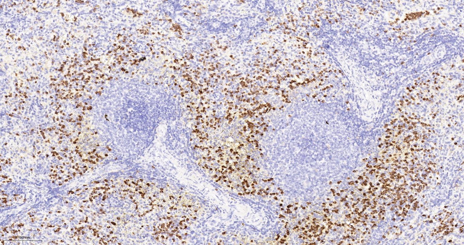 整合素αM单克隆抗体