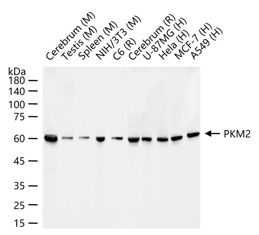丙酮酸激酶M2重组兔单抗