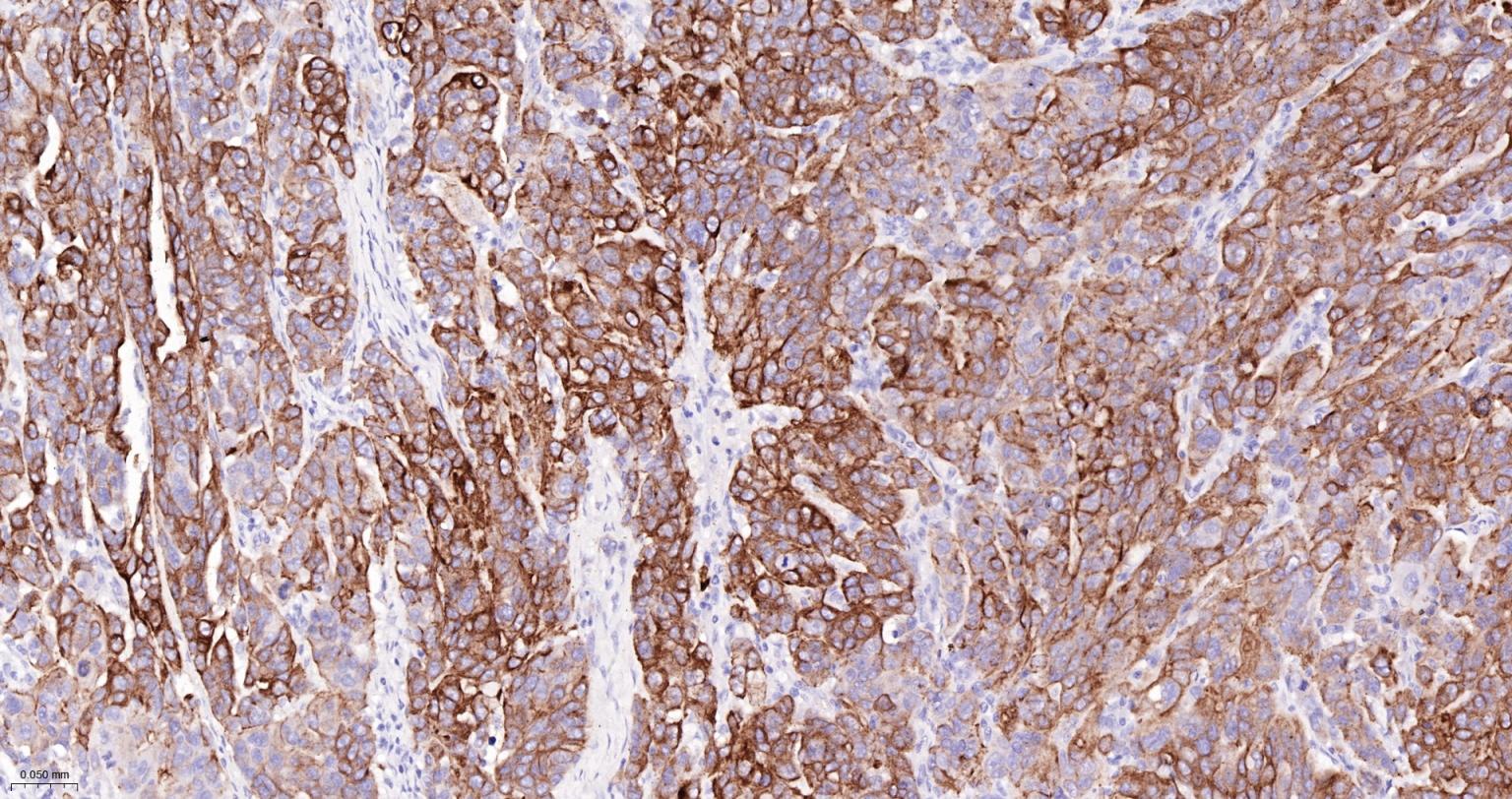 细胞角蛋白7重组兔单抗-bsm-60218R