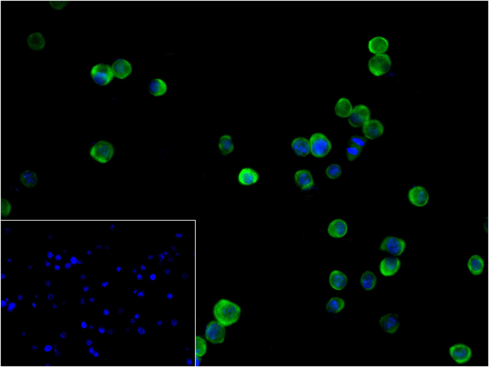 热休克蛋白90α重组兔单抗