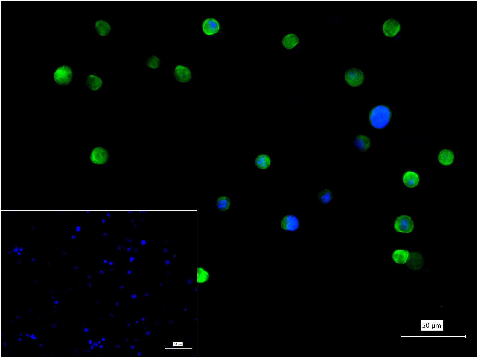 热休克蛋白90α重组兔单抗