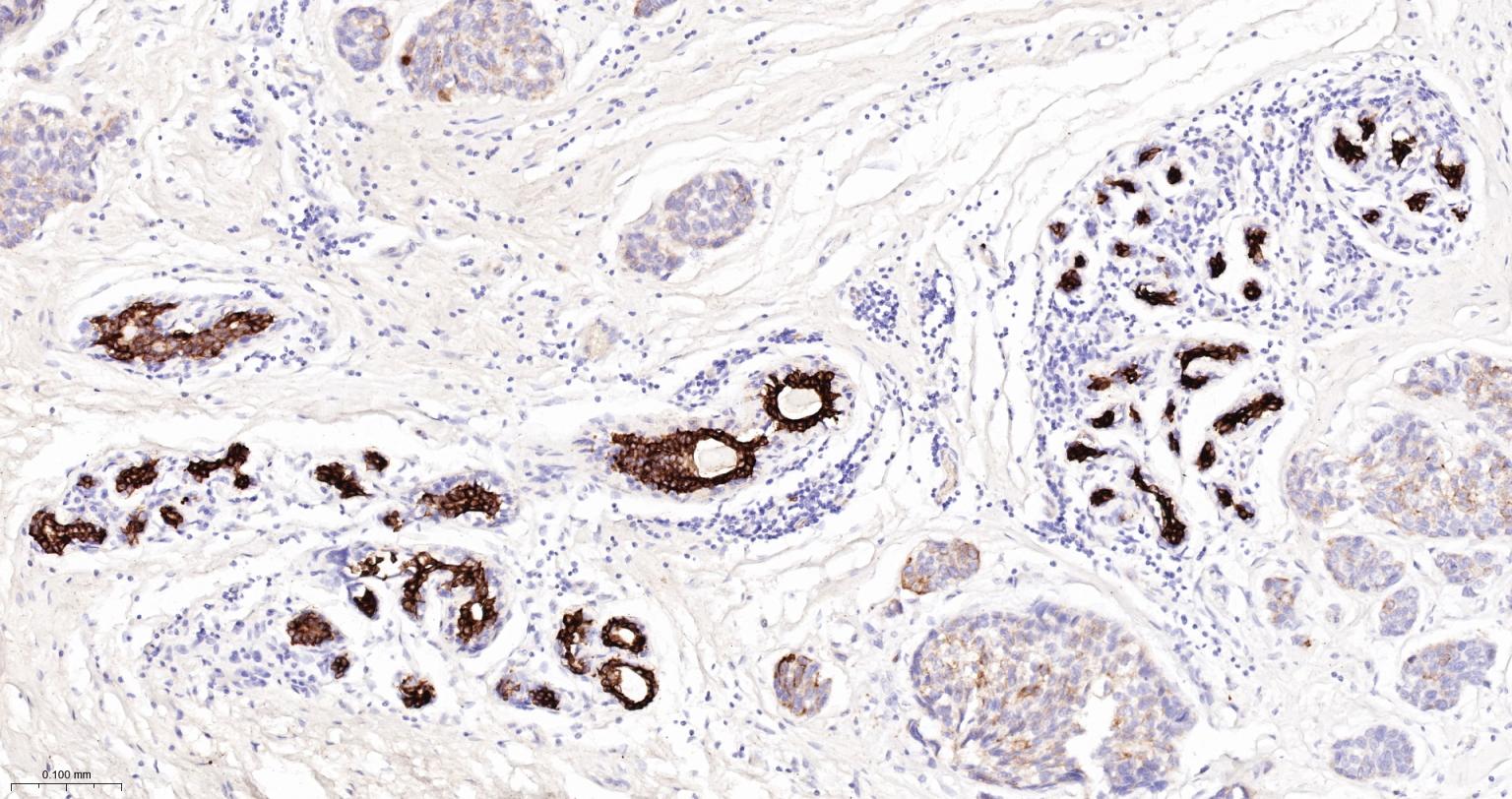 细胞角蛋白7重组兔单抗-bsm-60218R