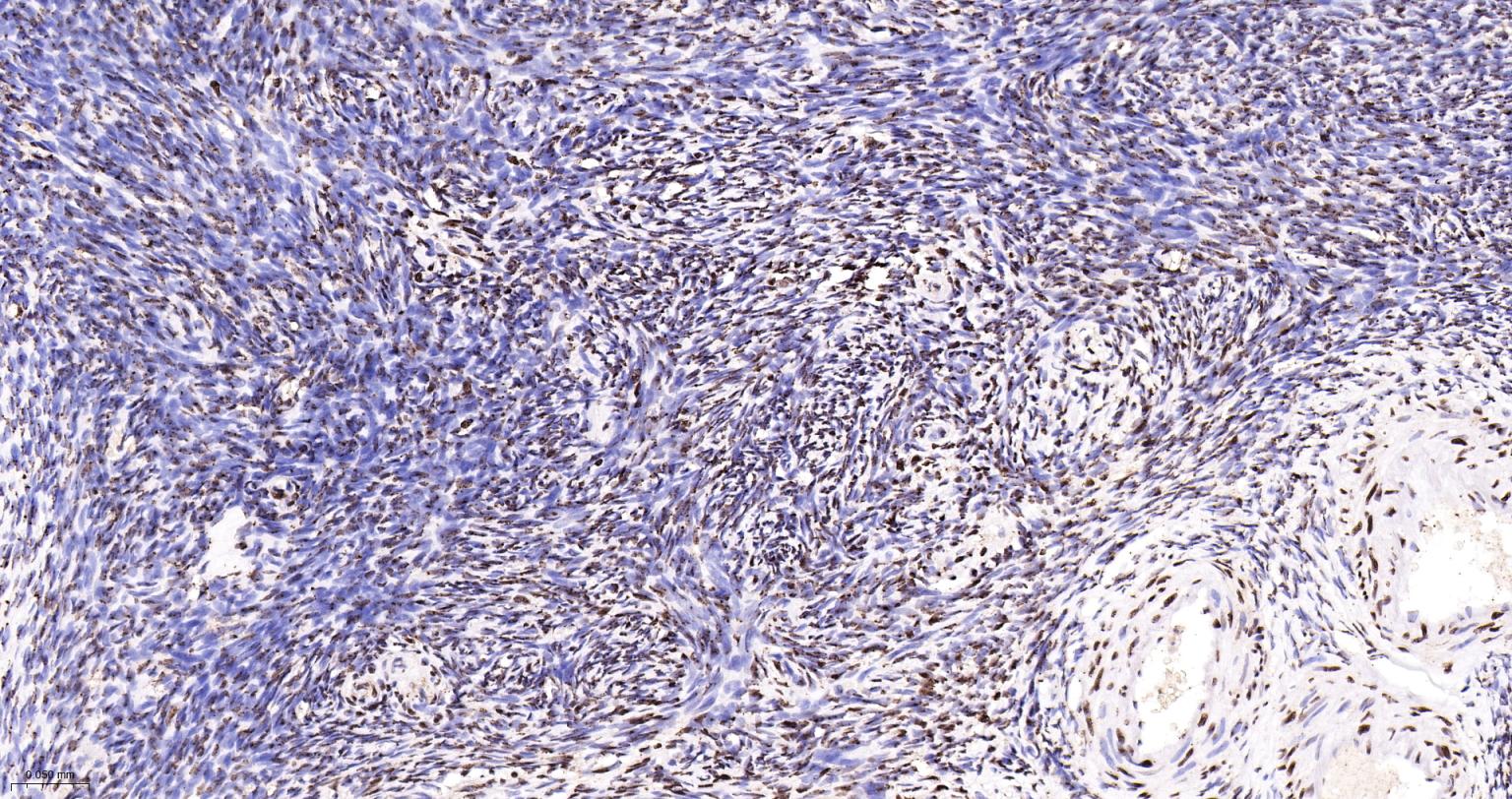 扑克蒙蛋白重组兔单抗