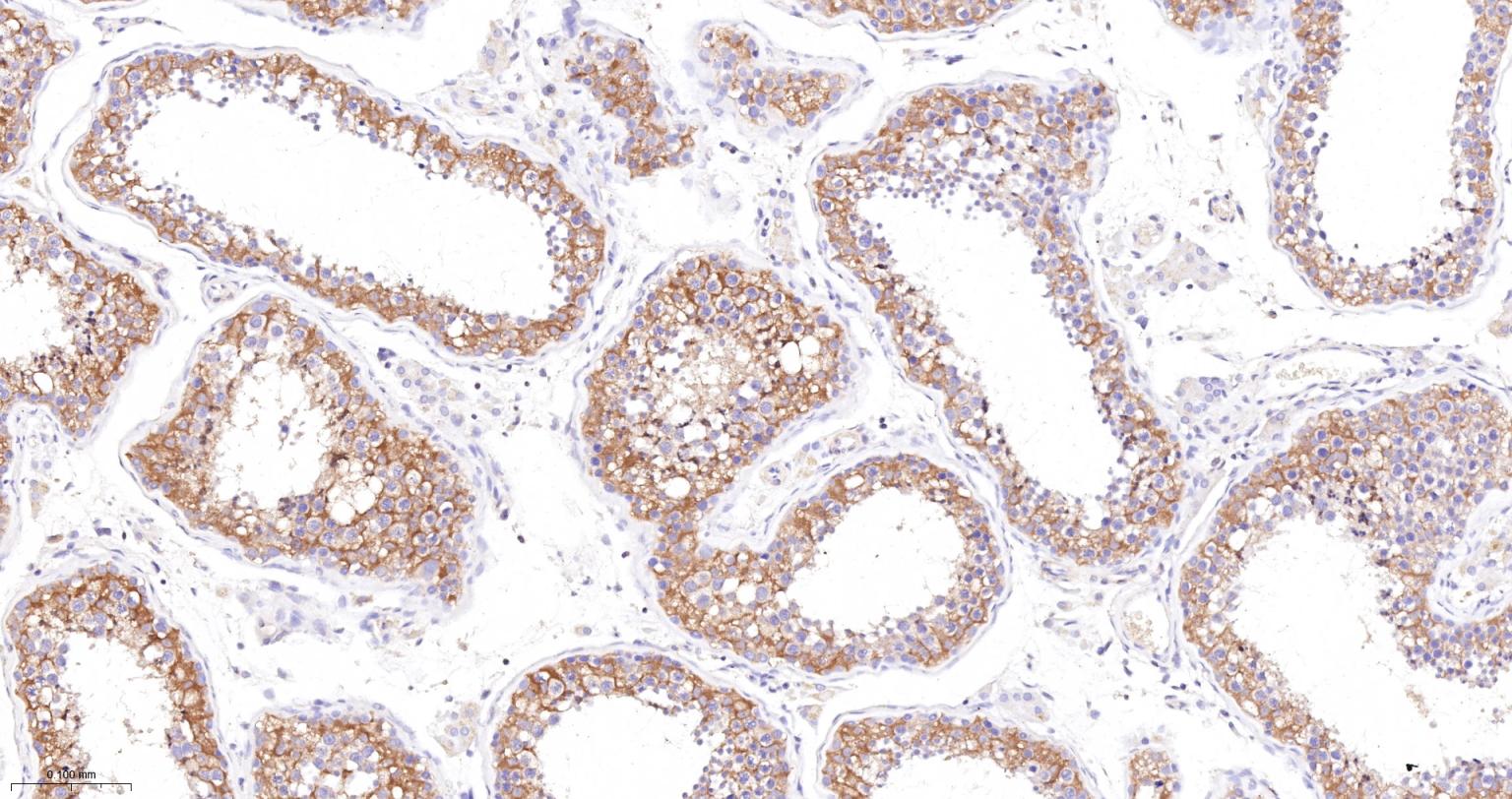 丙酮酸激酶M2重组兔单抗