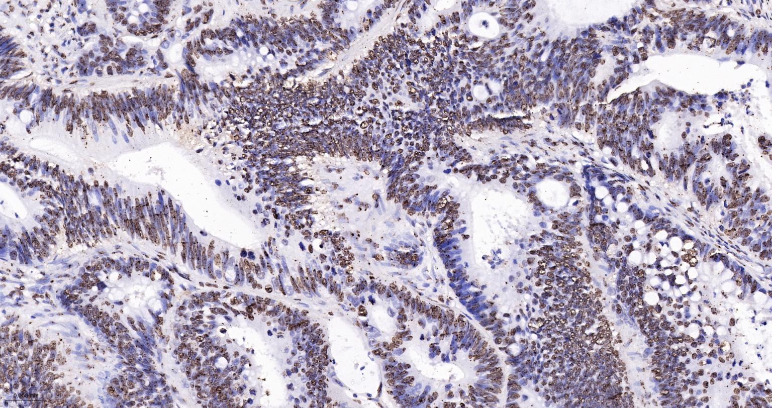 扑克蒙蛋白重组兔单抗