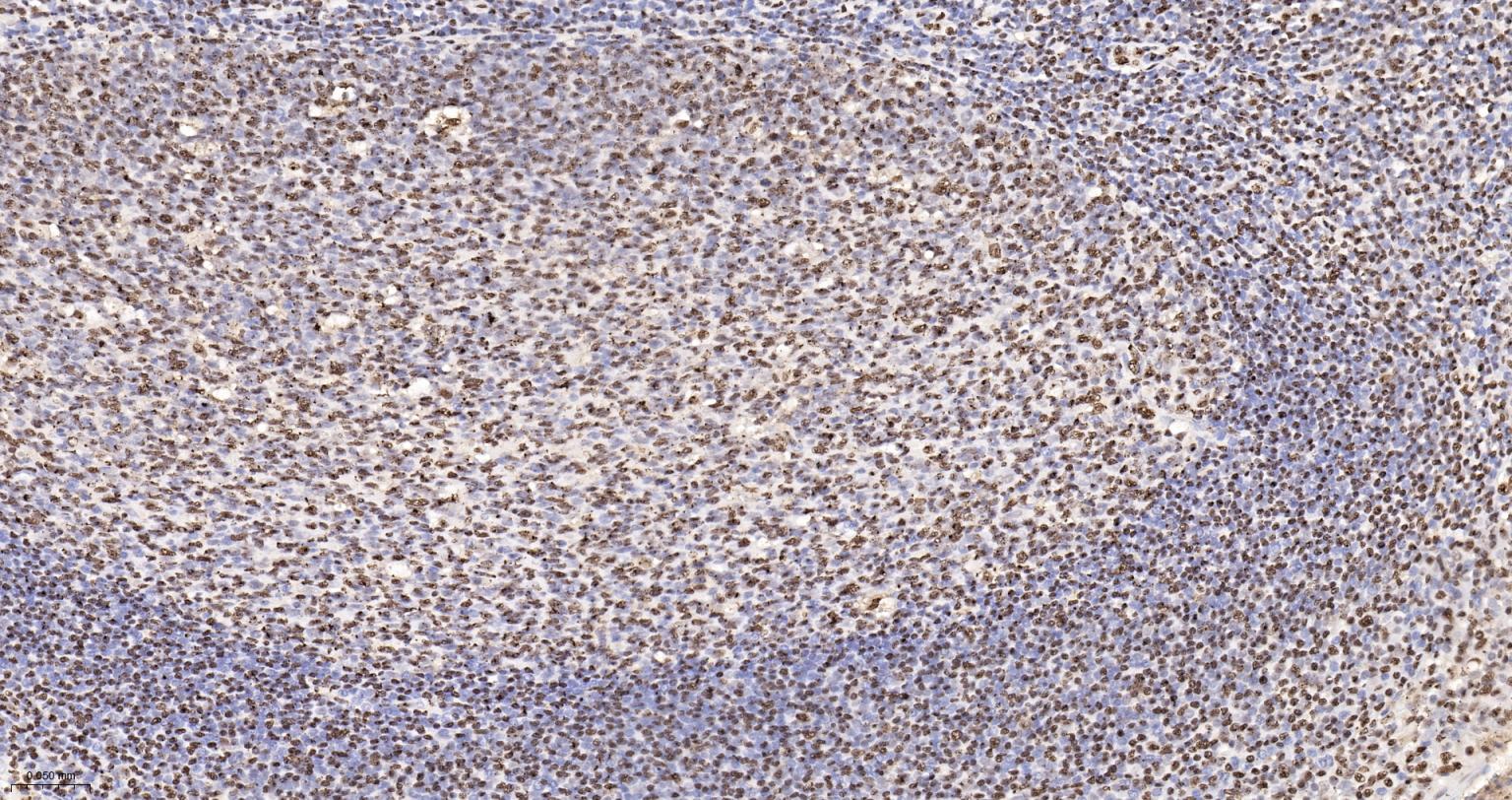 扑克蒙蛋白重组兔单抗