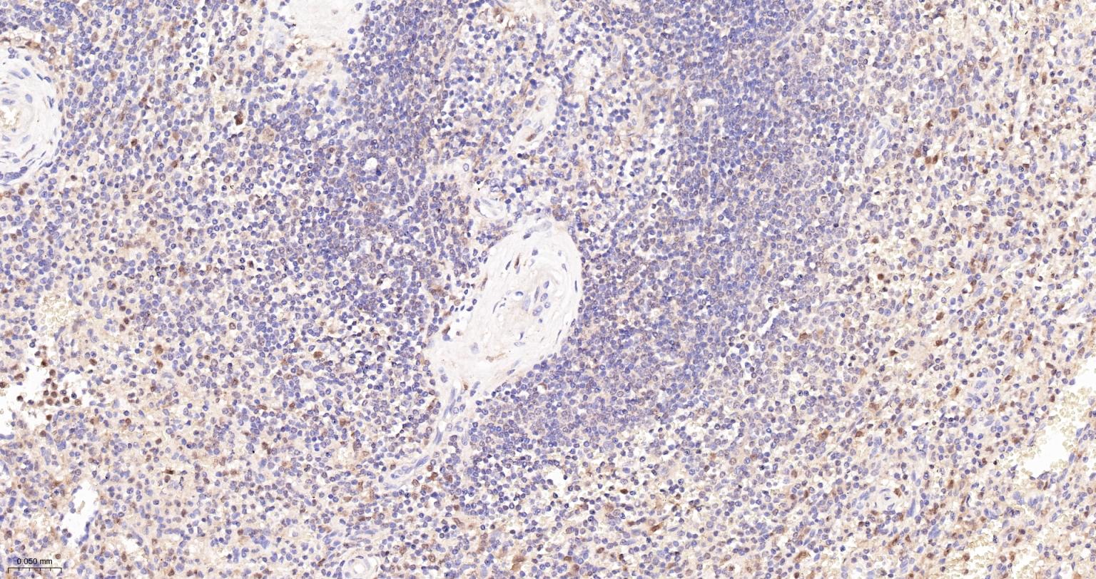 凋亡相关斑点样蛋白ASC重组兔单抗