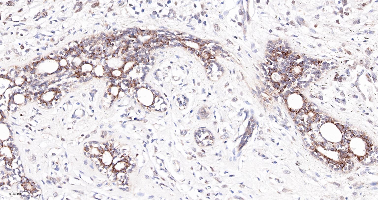 凋亡相关斑点样蛋白ASC重组兔单抗