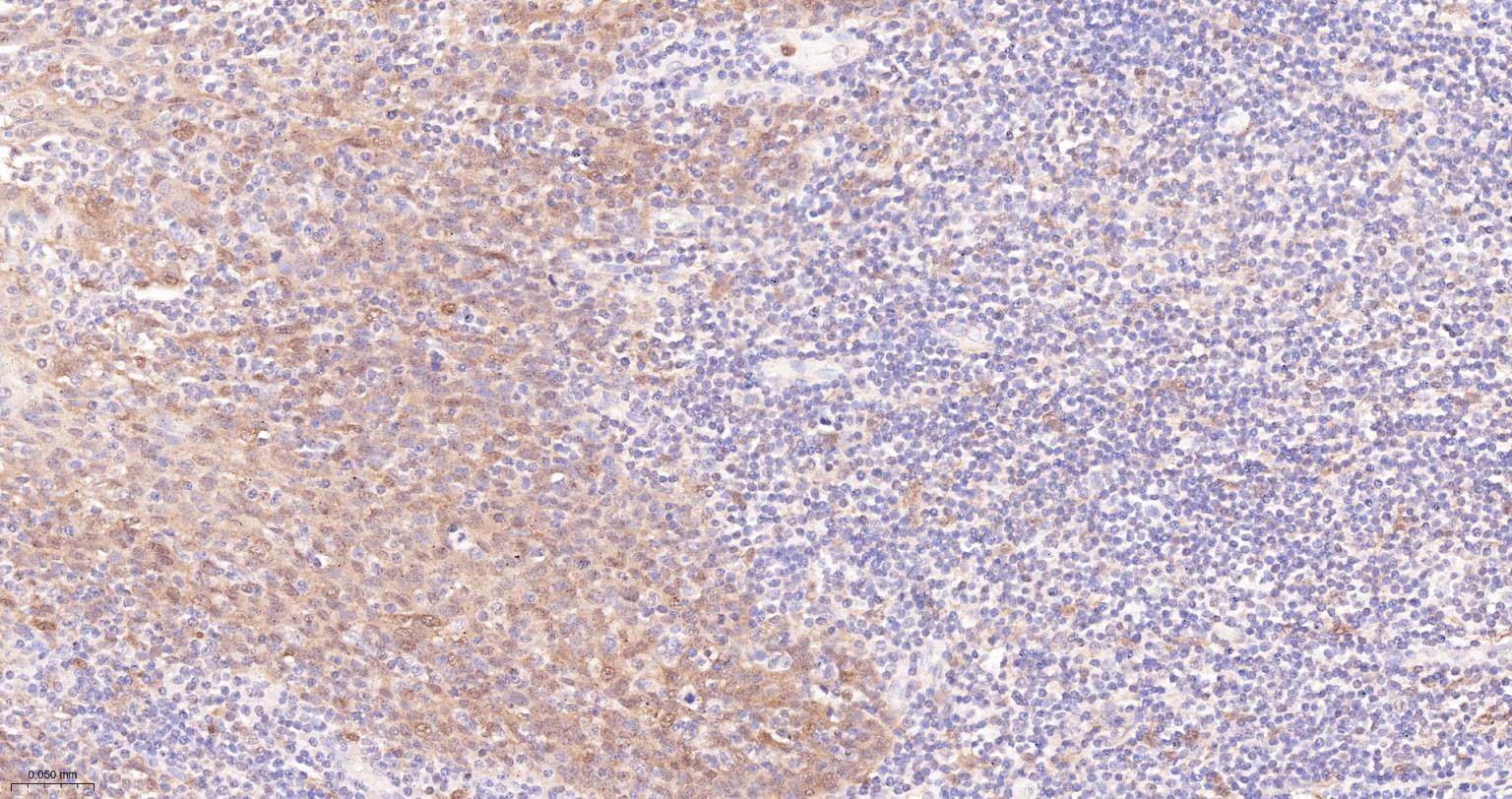 凋亡相关斑点样蛋白ASC重组兔单抗