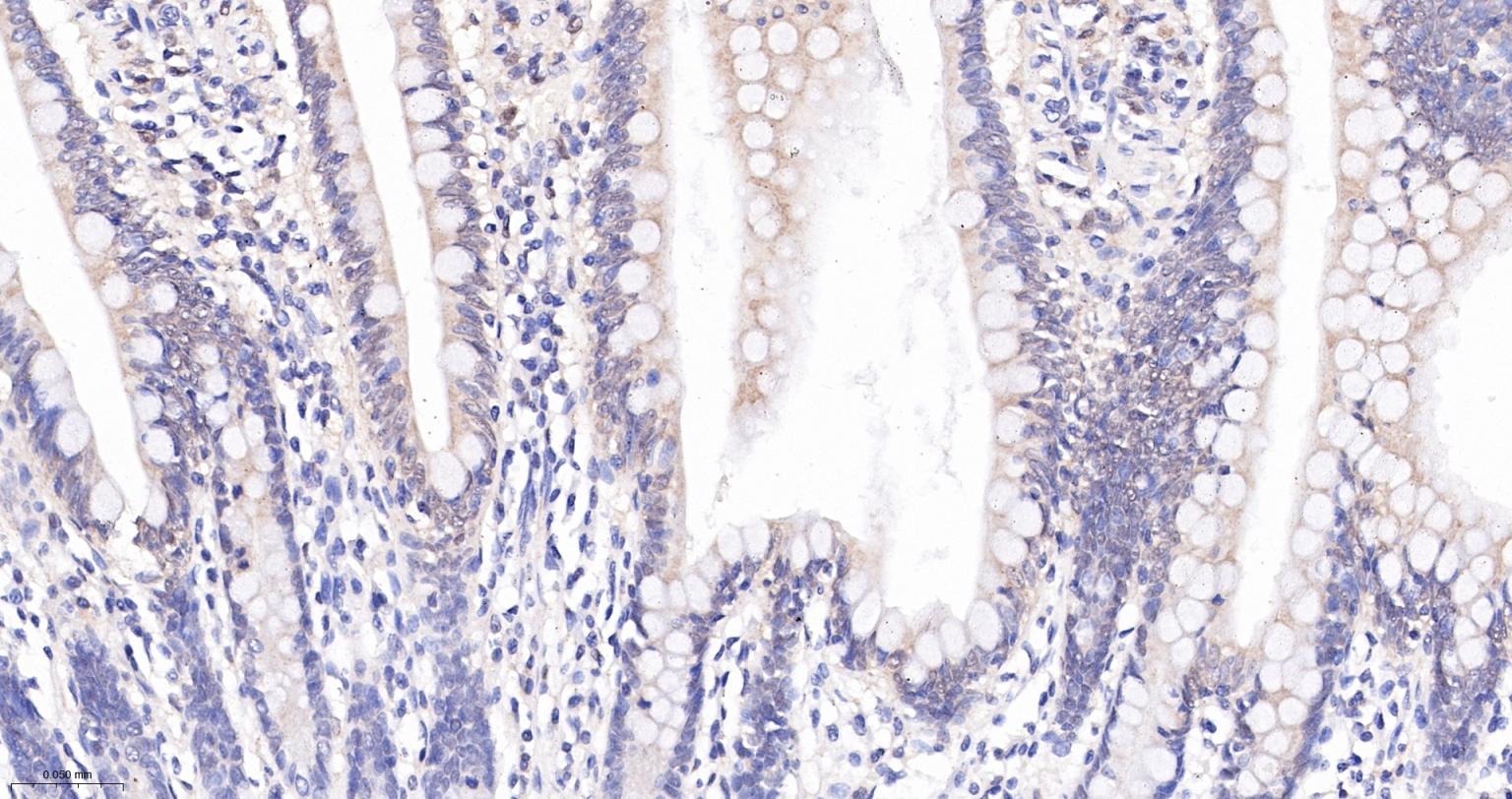 凋亡相关斑点样蛋白ASC重组兔单抗