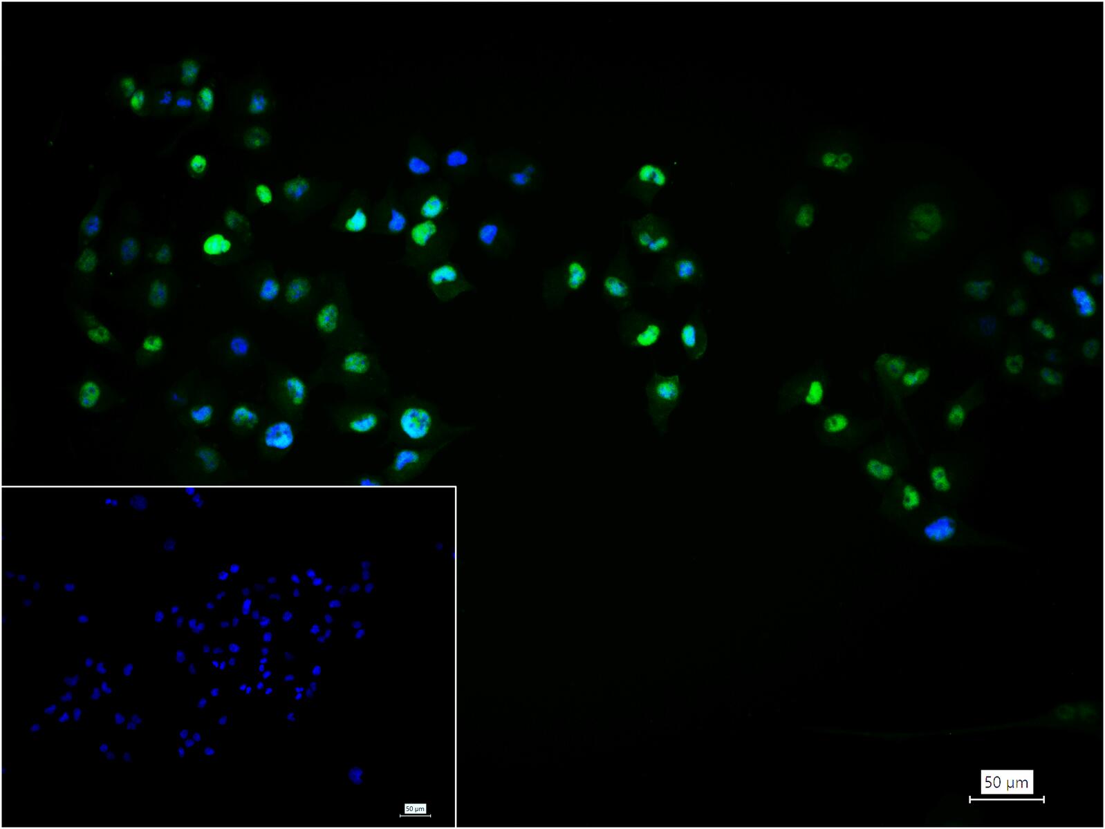 转录因子SOX9蛋白重组兔单抗