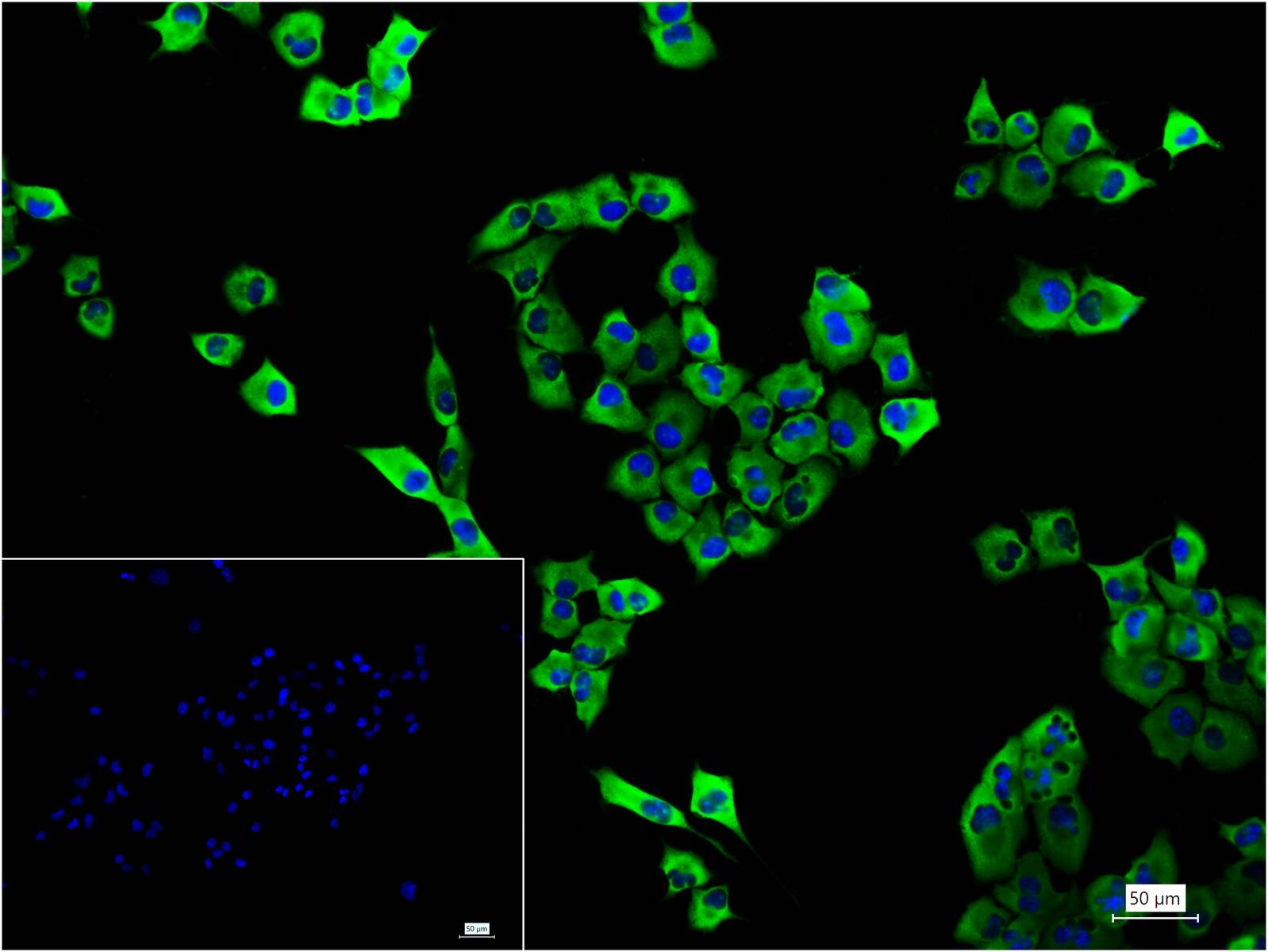 翻译延伸因子EF-1a重组兔单抗