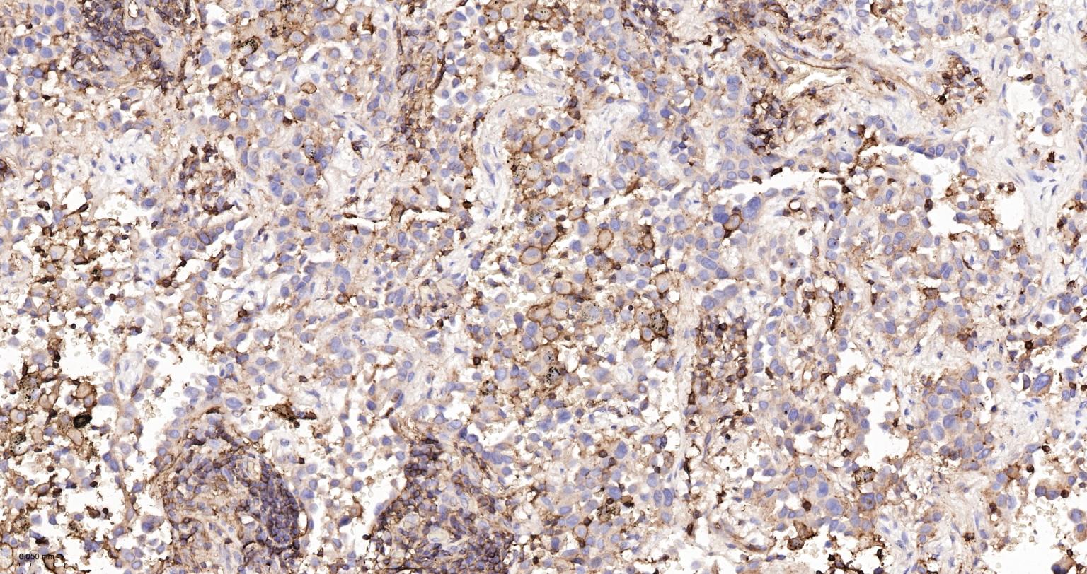 组织相容性抗原HLAF重组兔单抗