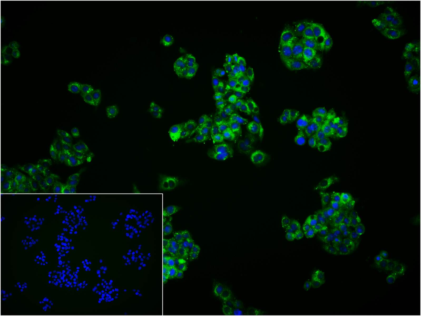 纤维连接蛋白抗体-bs-48086R